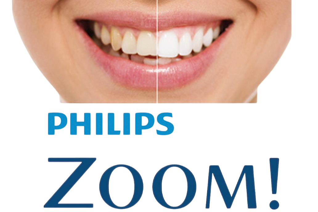 An image of Philips Zoom Whitening